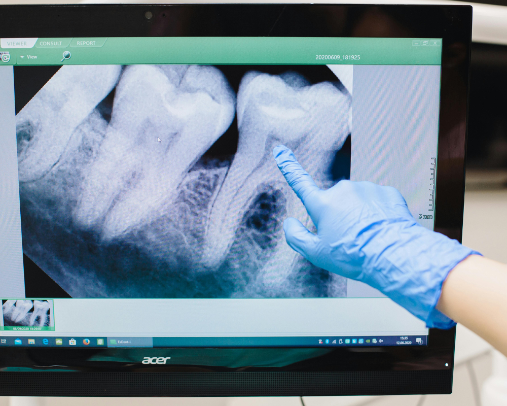 Escaneamento digital do sorriso: o futuro da odontologia já chegou